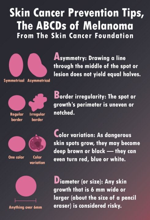 Melanoma Tips Melanoma Tips