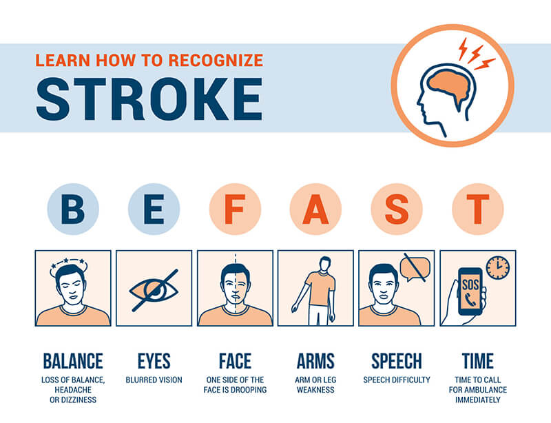 Knowing the Symptoms of a Stroke | Homewatch CareGivers