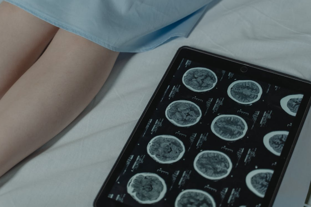 brain imaging next to legs on bed