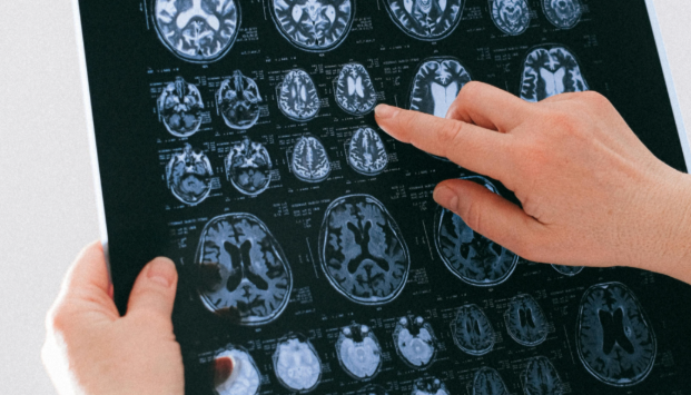 brain scan chart with finger pointing at one image