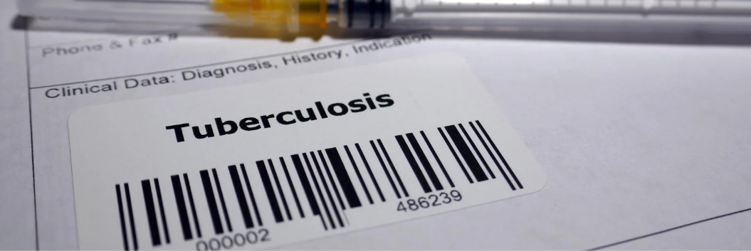 The Basics of Tuberculosis